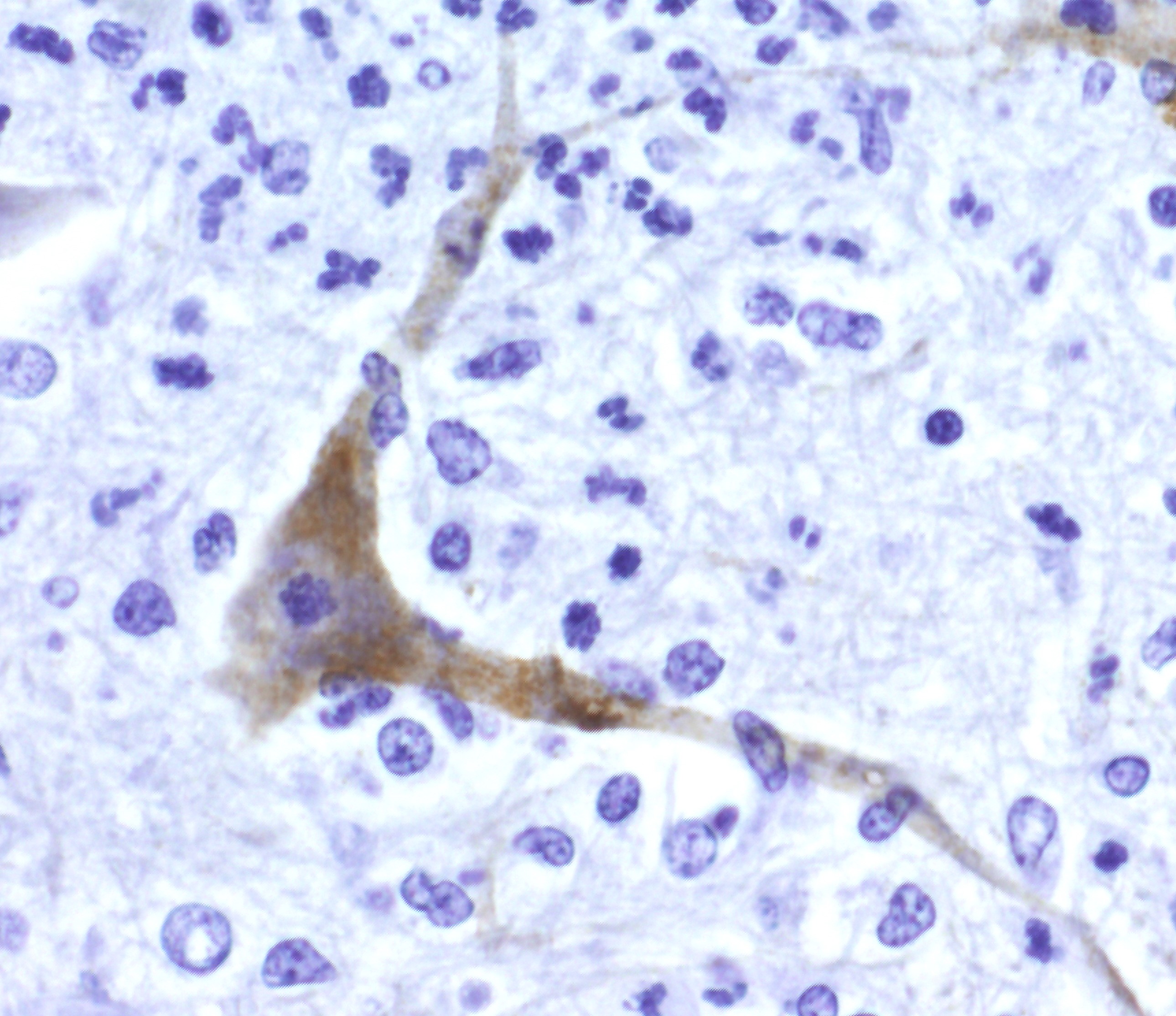 microscopic image of Eastern Equine Encephalitis